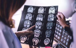 Brain Awareness Week 2025